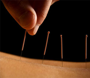 popular-procedure-ayurveda-main